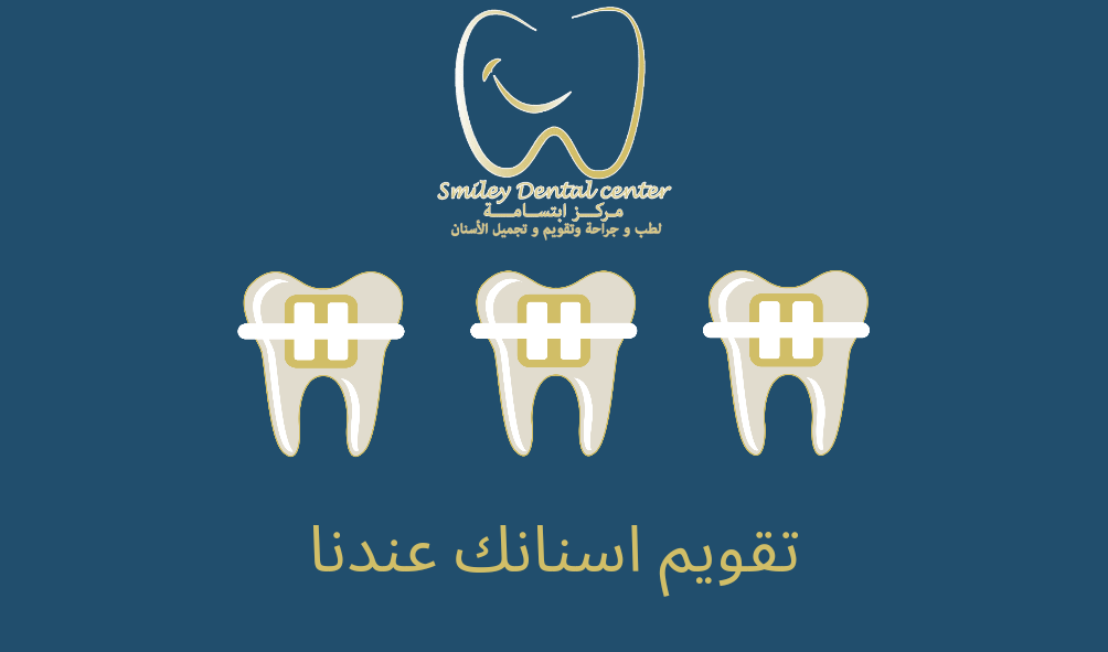 تقويم الاسنان