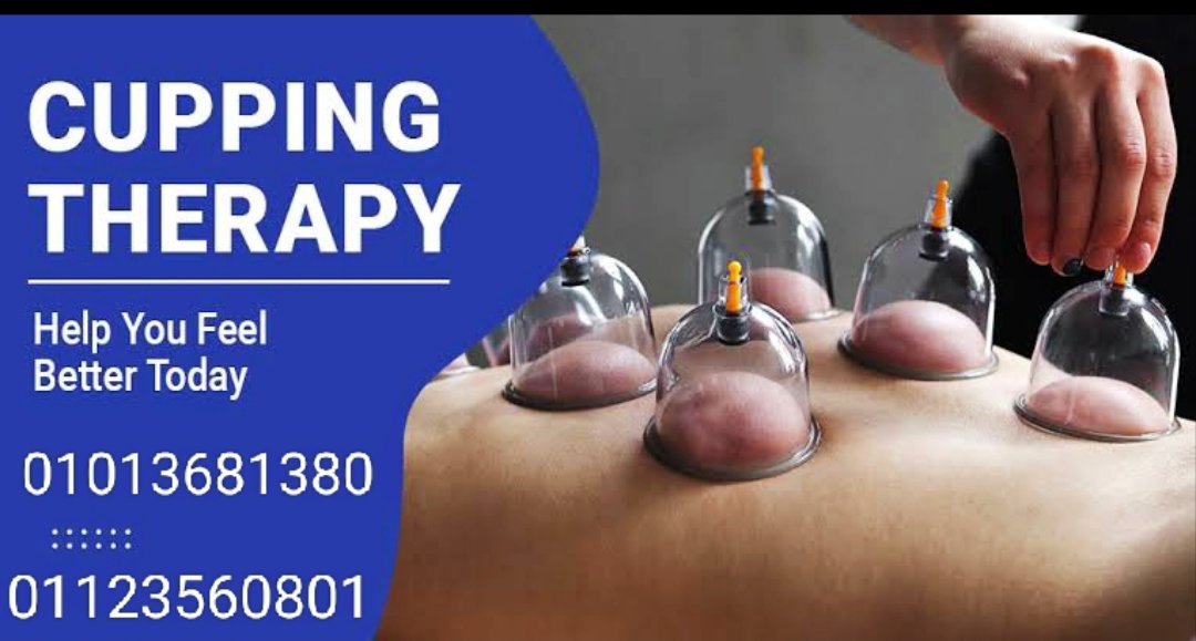 الحجامة الوقائية