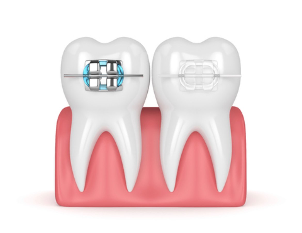 Orthodontist