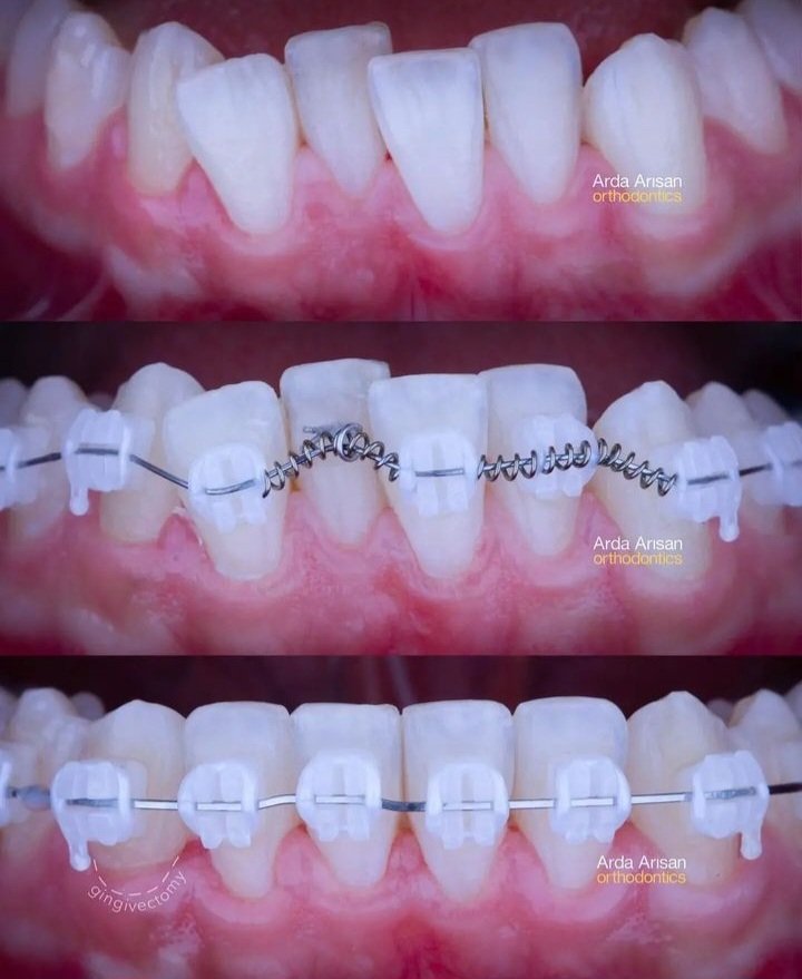 ortho treatment