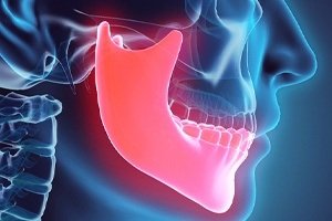 TMJ Disorder (مشاكل الفك)