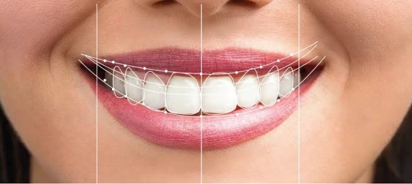 DSD (Digital Smile Design)
