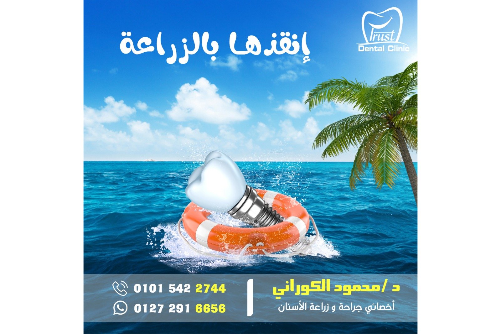 زراعة الأسنان - Dental implants