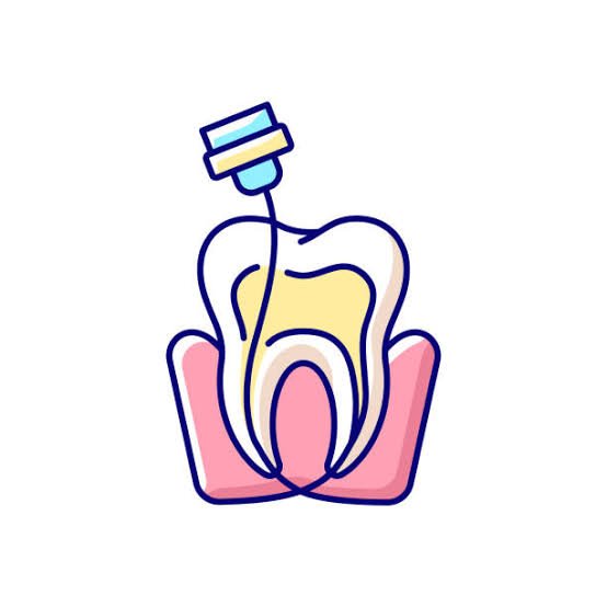 Root canal treatment